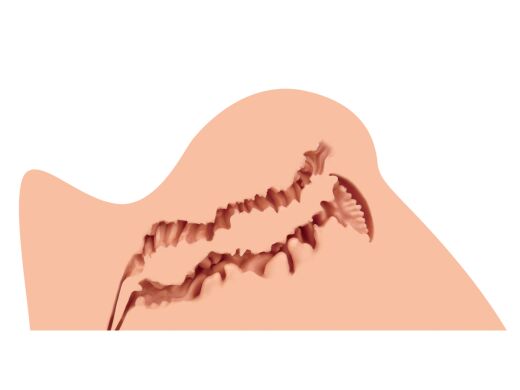 Мастурбатор Naked Factory TRISHA B TYPE, виражені статеві губи, вагіна + анус, дуже реалістичний